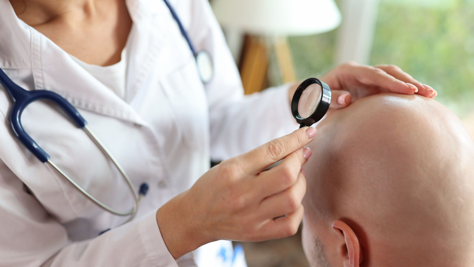 What are the Long-term results expected after a hair transplant?