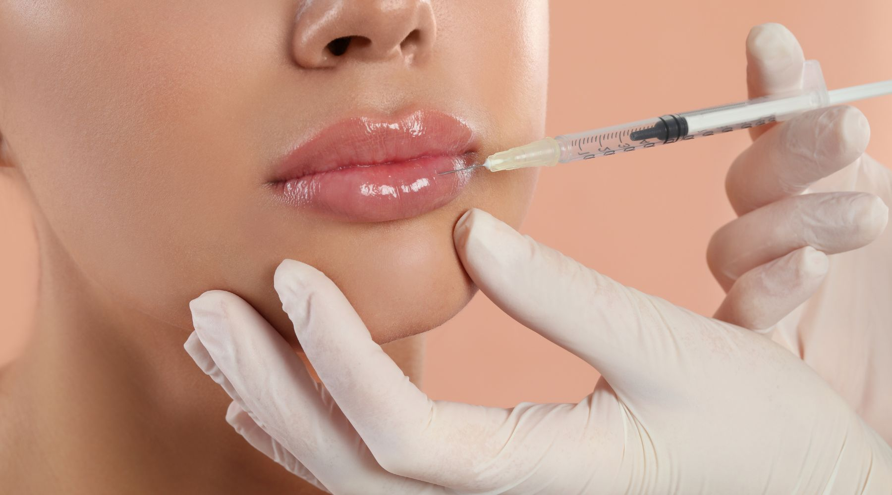 Lip injection procedure with a syringe and gloves.