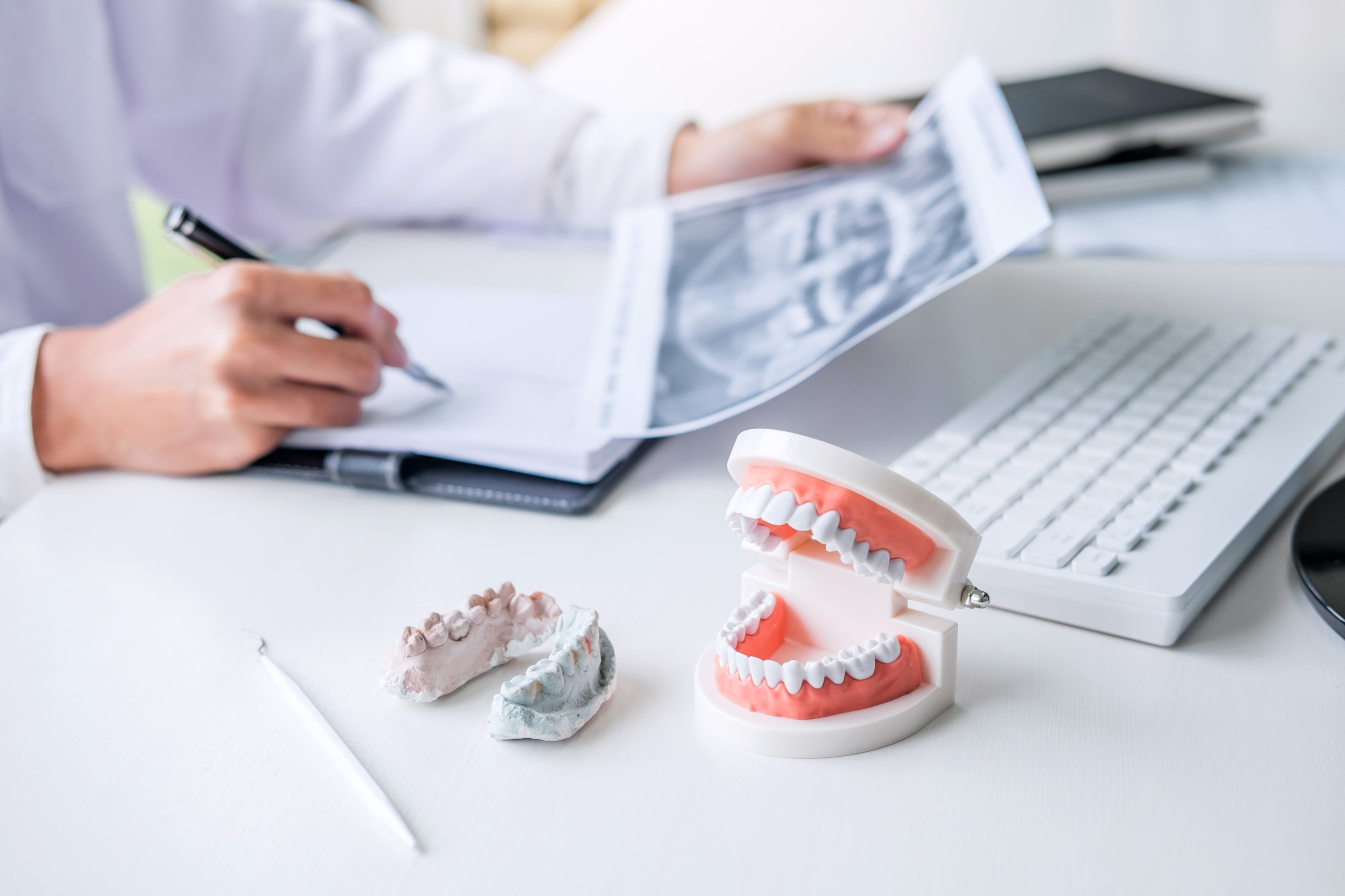 Dental models showing how to prevent oral cancer 