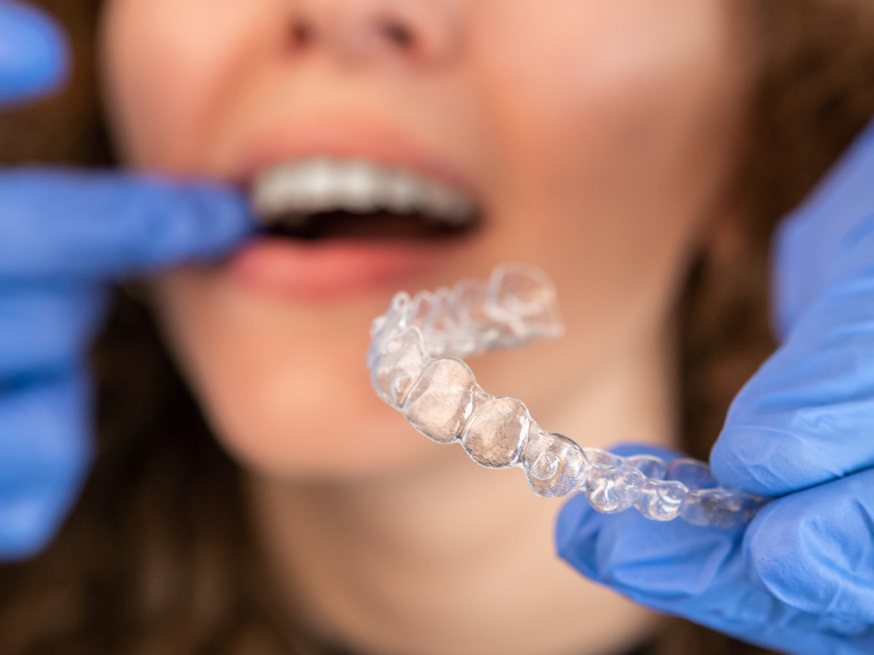Image of an Invisalign aligner, a popular choice for straightening crooked teeth.