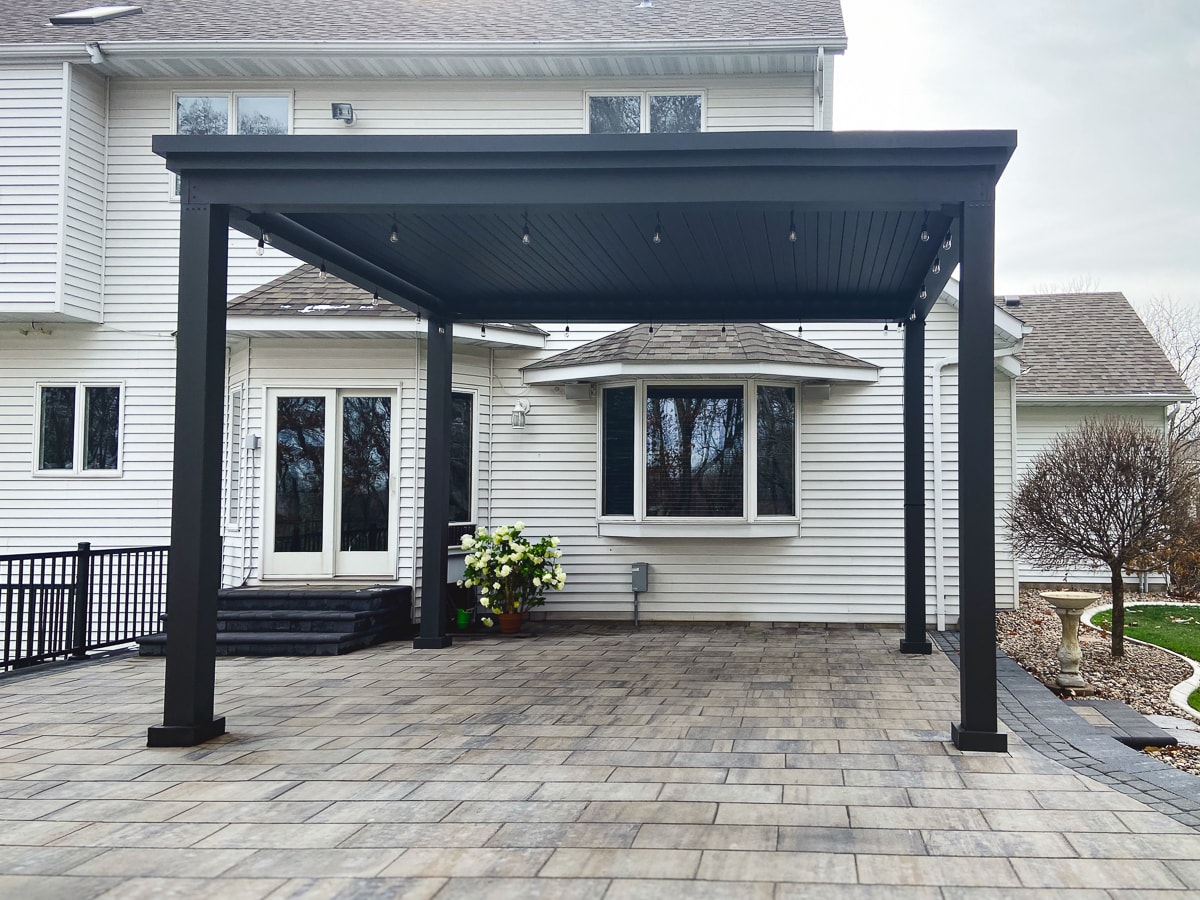 A remote controlled pergola kit can instantly upgrade your space.