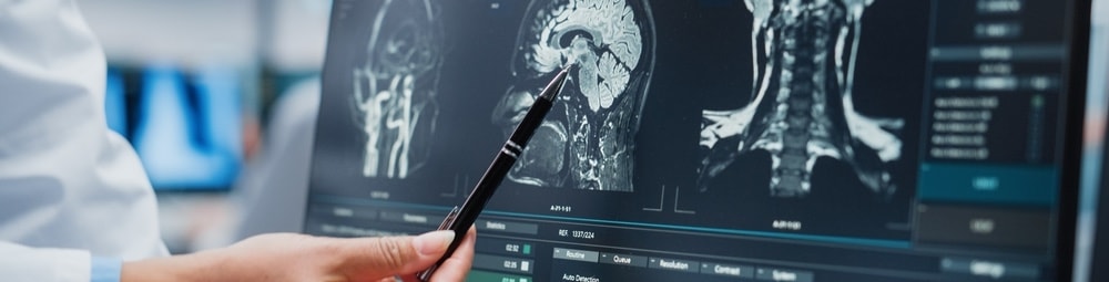 The recovery process for traumatic brain injury to strengthen brain circuits damaged.