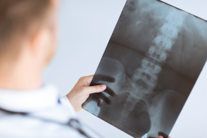 spinal-cord-injuries