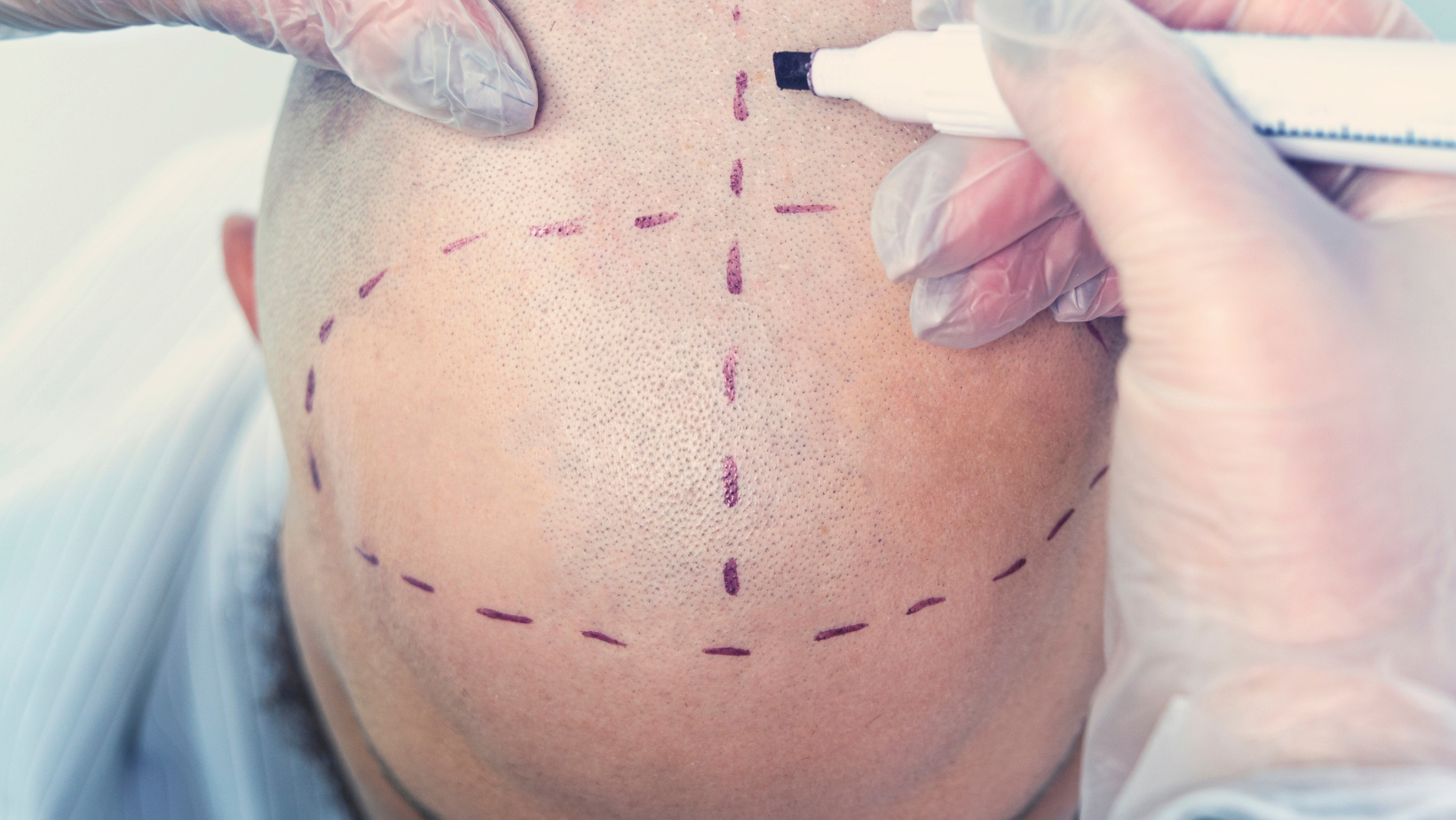 Aftercare and maintaining recommendations