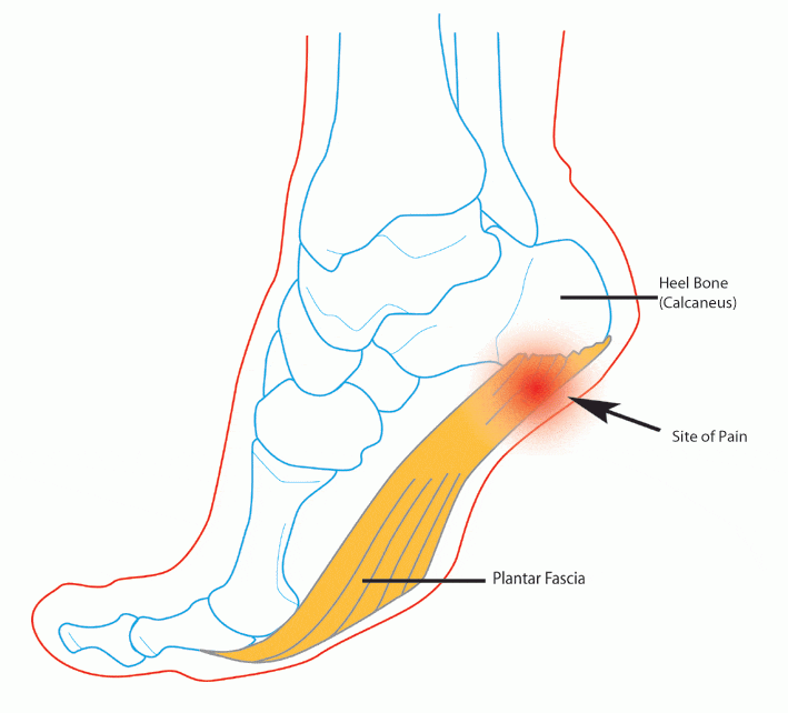 The Best Arch Support Thongs Australia for plantar fasciitis.