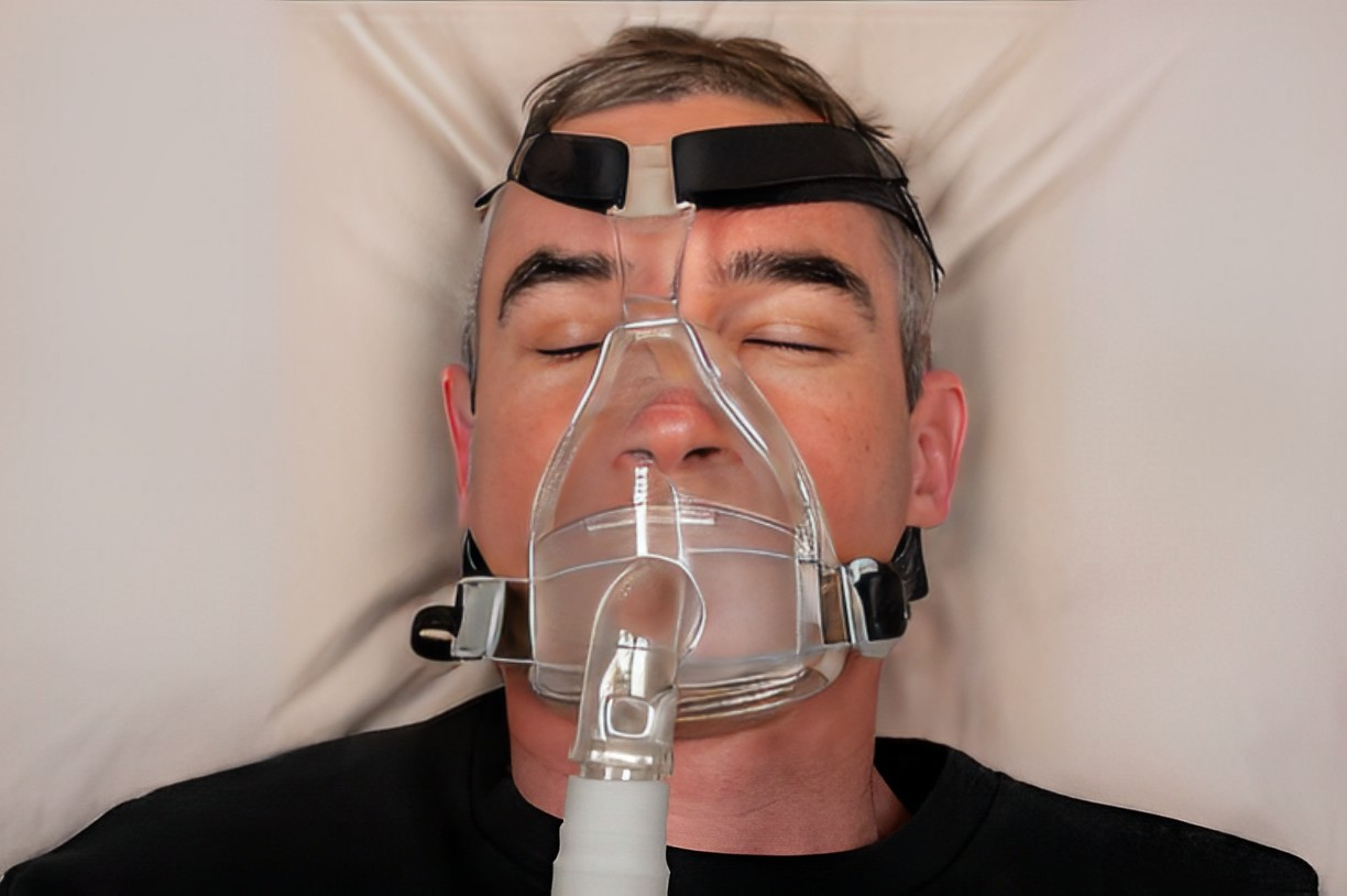 A photo of a man wearing CPAP headgears