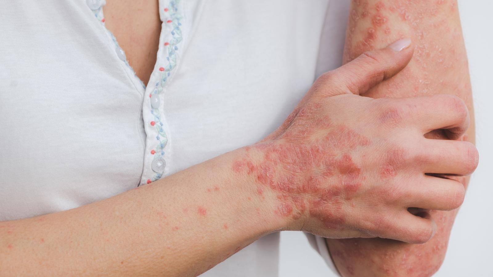 itchy skin