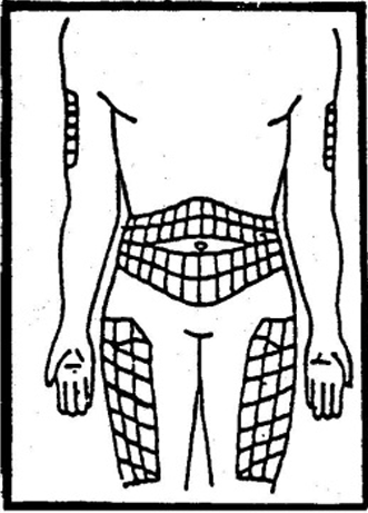 hcg injection sites 