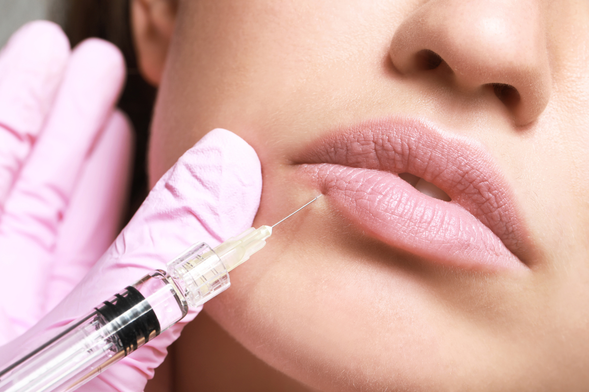 A Botox Treatment can be injected in various facial locations such as the lips, forehead, or eyebrows. Woman pictured for example purposes only.