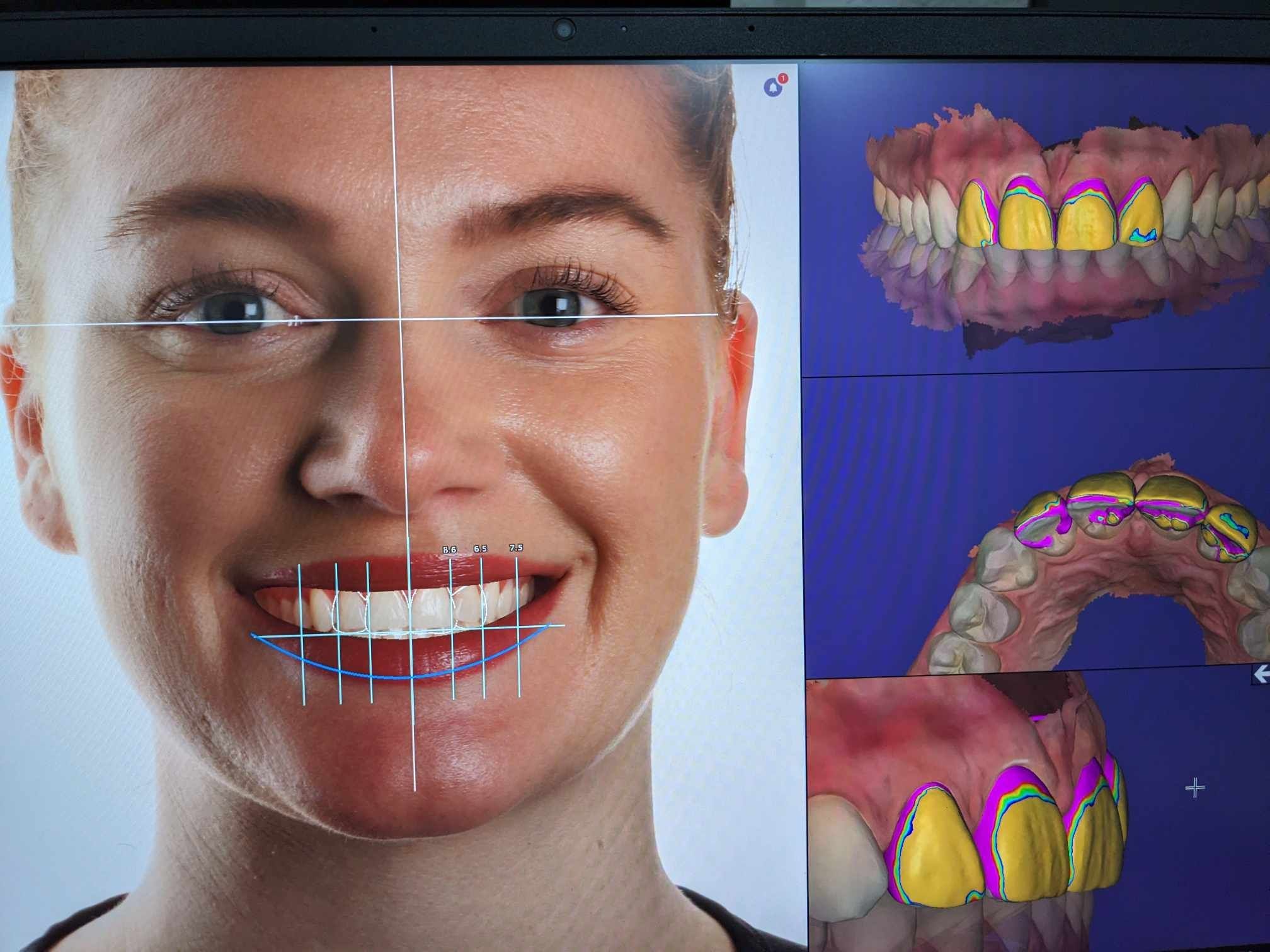 Individuals considering digital smile design for their dental needs.