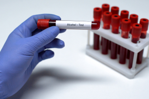 Improper administration of a blood test or protocol