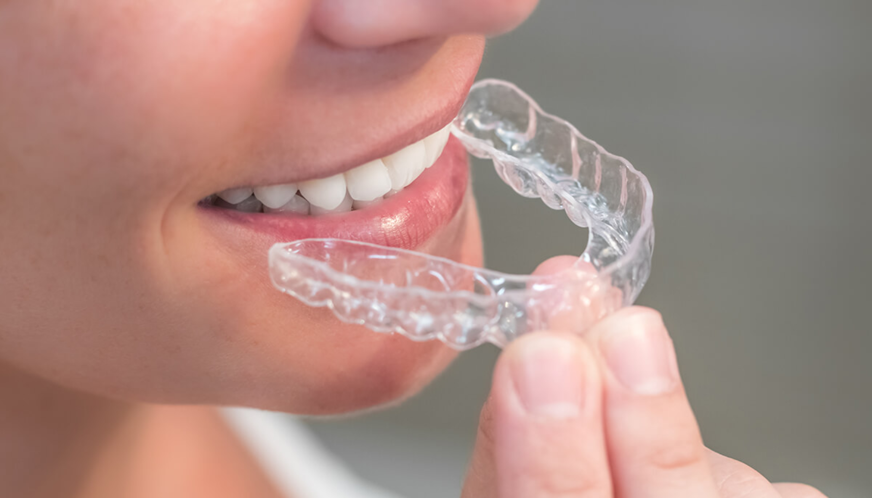 Invisalign – Usynlig tannregulering for voksne og ungdom 1 Person holder en gjennomsiktig tannskinne foran munnen, klar til å sette den inn.