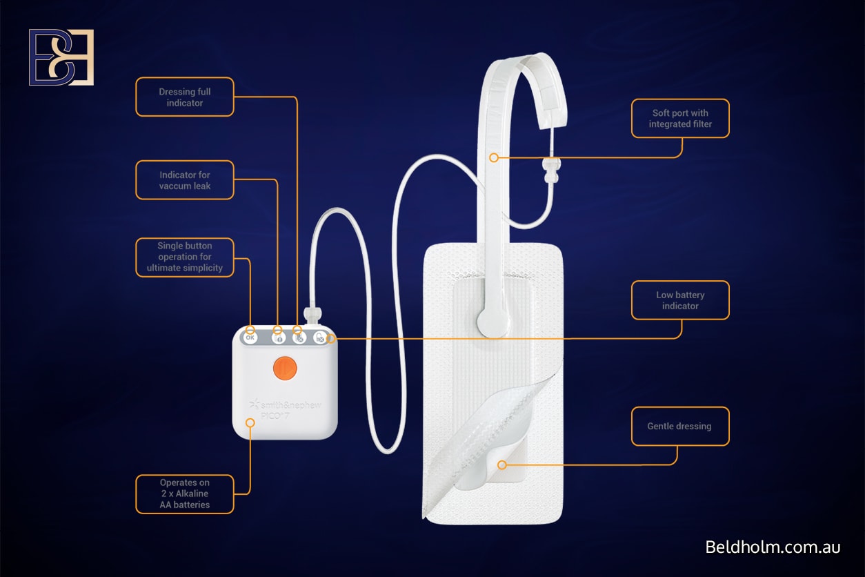 Recovery After a Circumferential Hybrid Abdominoplasty 7 PICO negative pressure wound dressings | Dr Bernard Beldholm
