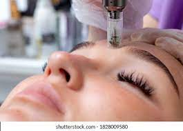 1,788 Microneedling Images, Stock Photos & Vectors | Shutterstock