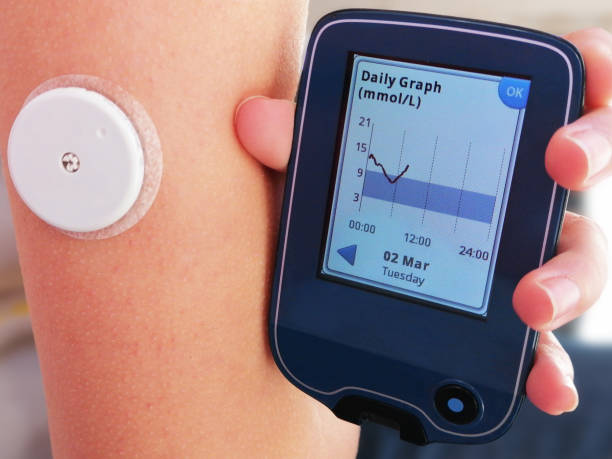 blood glucose skin monitor