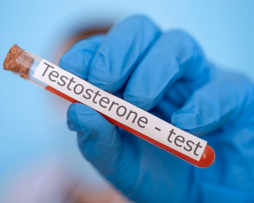 male menopause