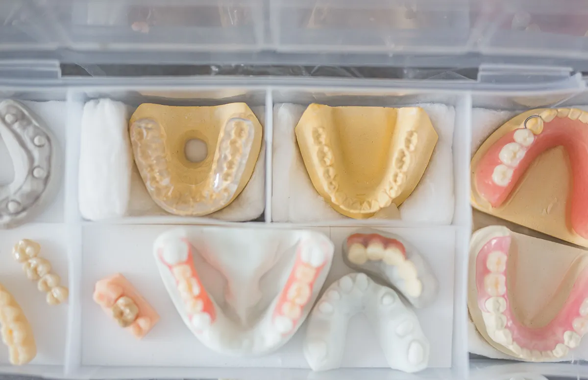 Organized tray of various dental casts and prosthetic models