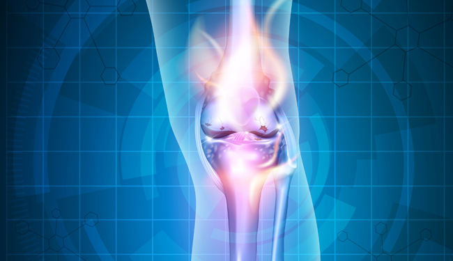 X-ray image of knee