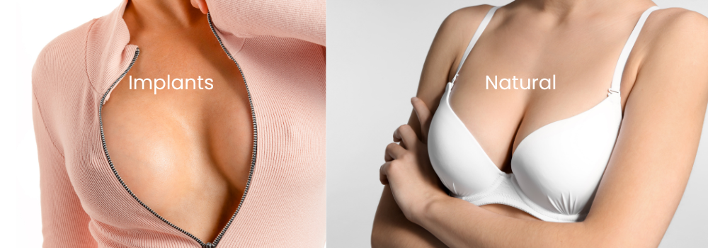 Implants vs natural breast augmentation