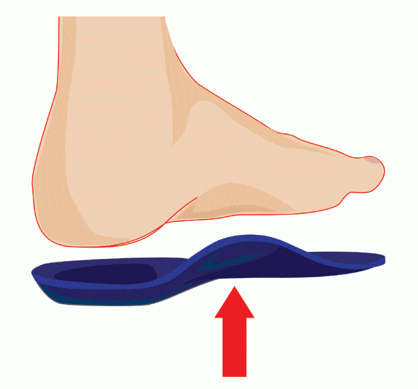 What Orthotics Are Good for Plantar Fasciitis? Ergonx