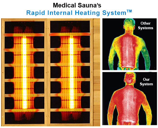 How Does a Medical Sauna Work?