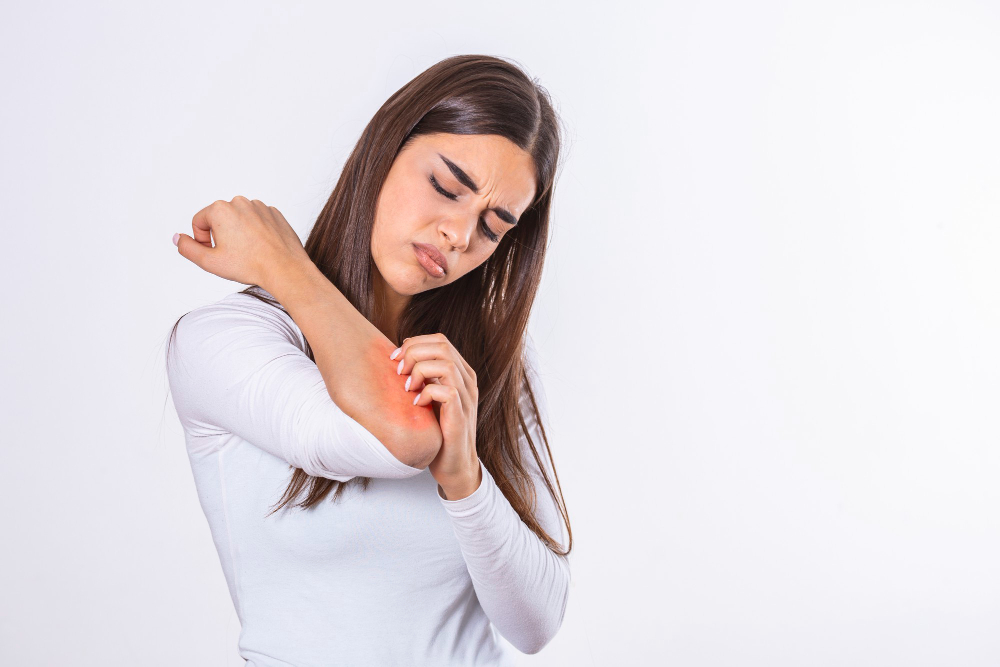 eczema-itching-skin irritation