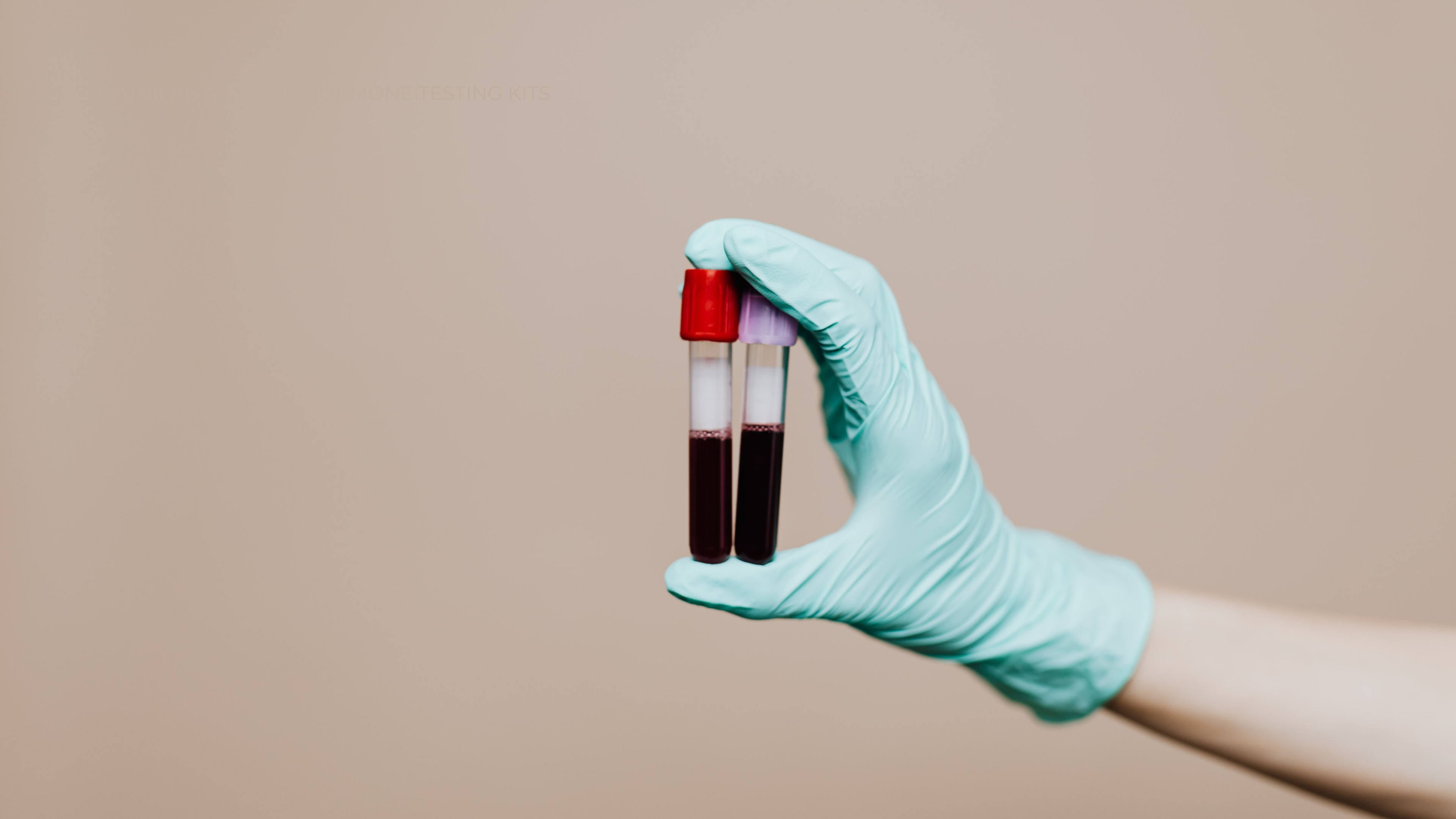 Blood samples in the hands of a person wearing latex gloves.