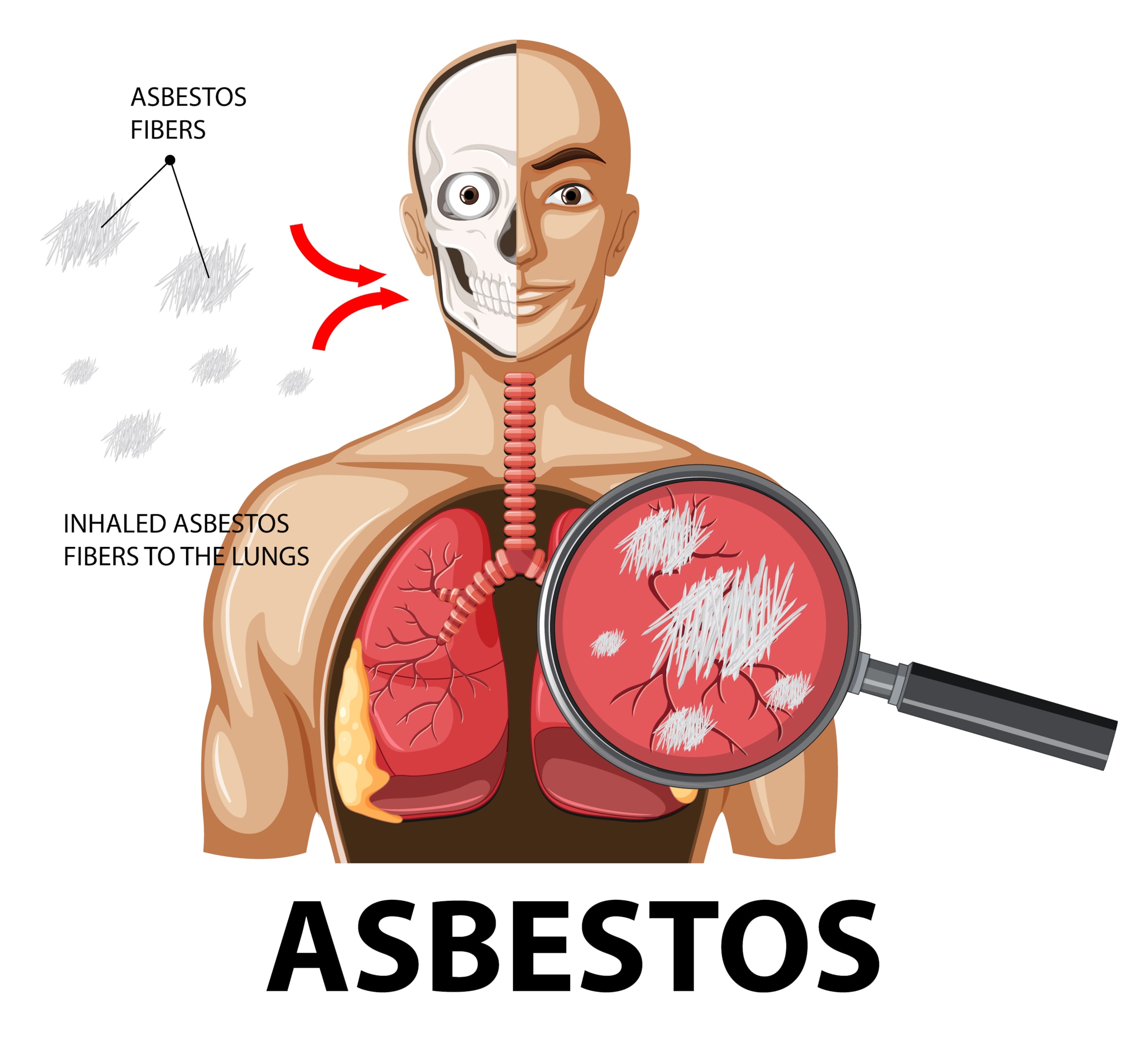 Can I Sue if the Deceased Had No Direct Asbestos Exposure?