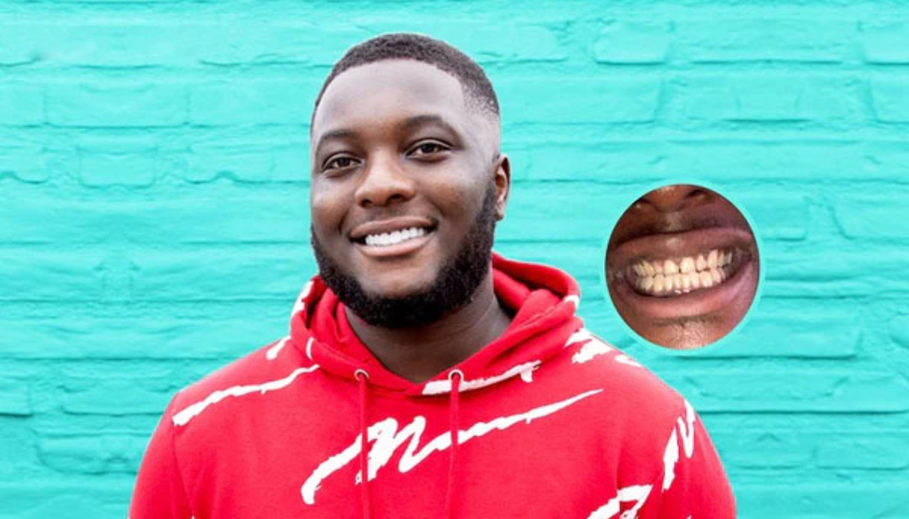 Falske tenner som ser ekte ut – Moderne løsninger for et naturlig smil 17 "Smilende mann i rød hettegenser foran turkis vegg, med nærbilde av tenner vist i sirkel."