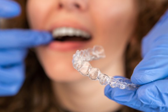 Woman getting aligners after answering the question, is Invisalign faster than braces?
