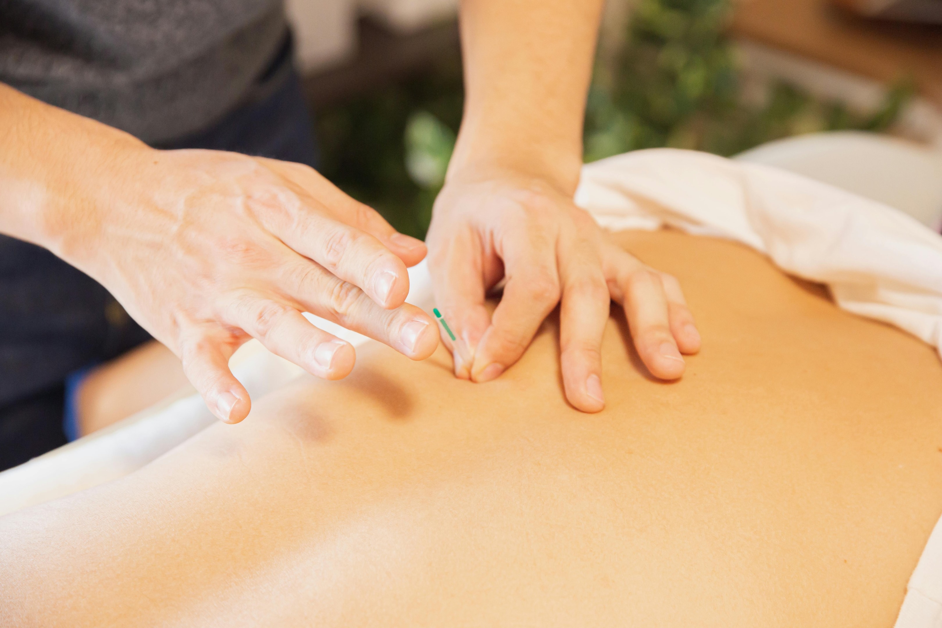 acupuncture treatments to relieve pain from cancer treatments