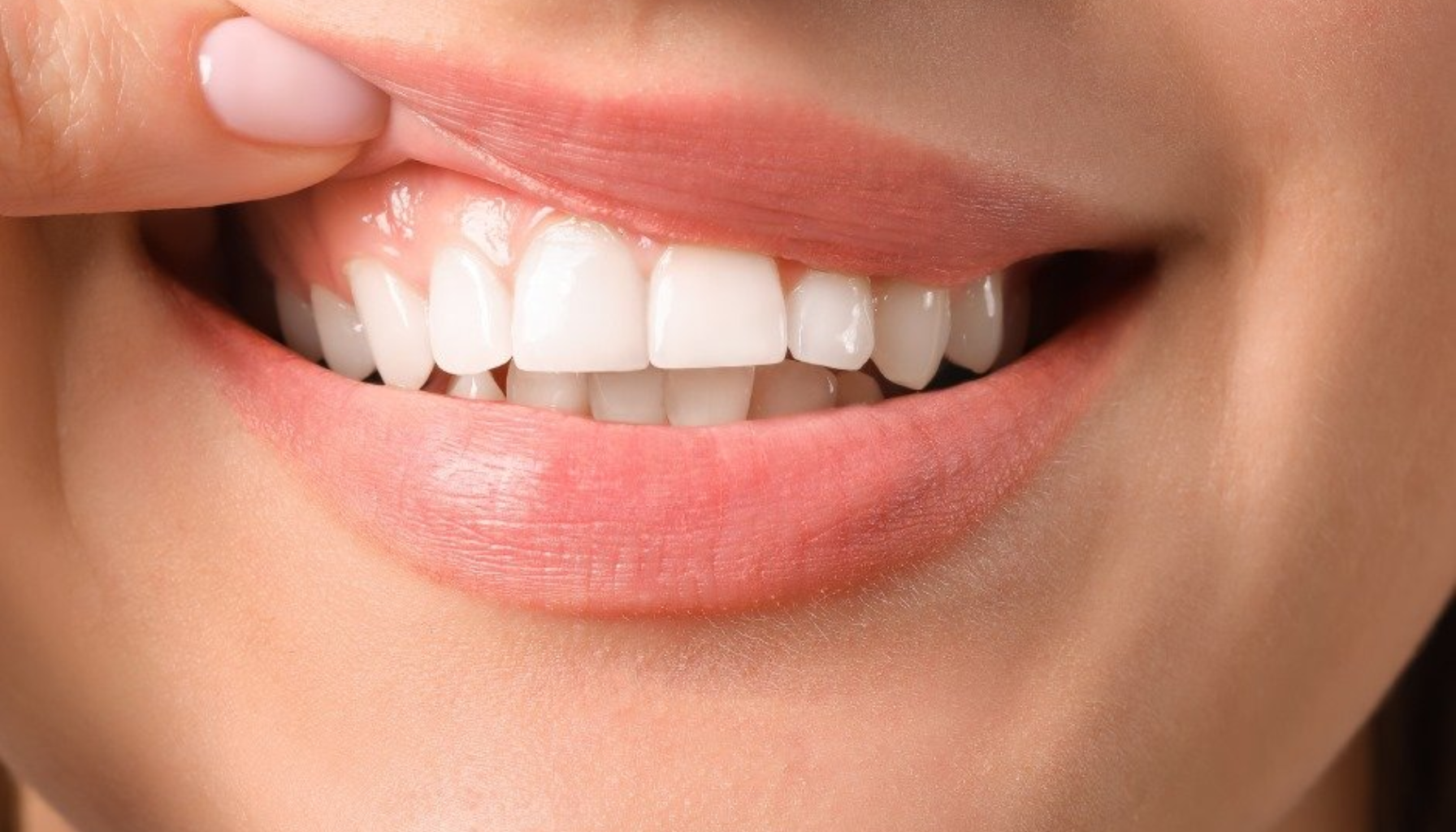 Nærbilde av en kvinne som smiler og løfter overleppen for å vise friskt, rosa tannkjøtt og hvite, rene tenner.