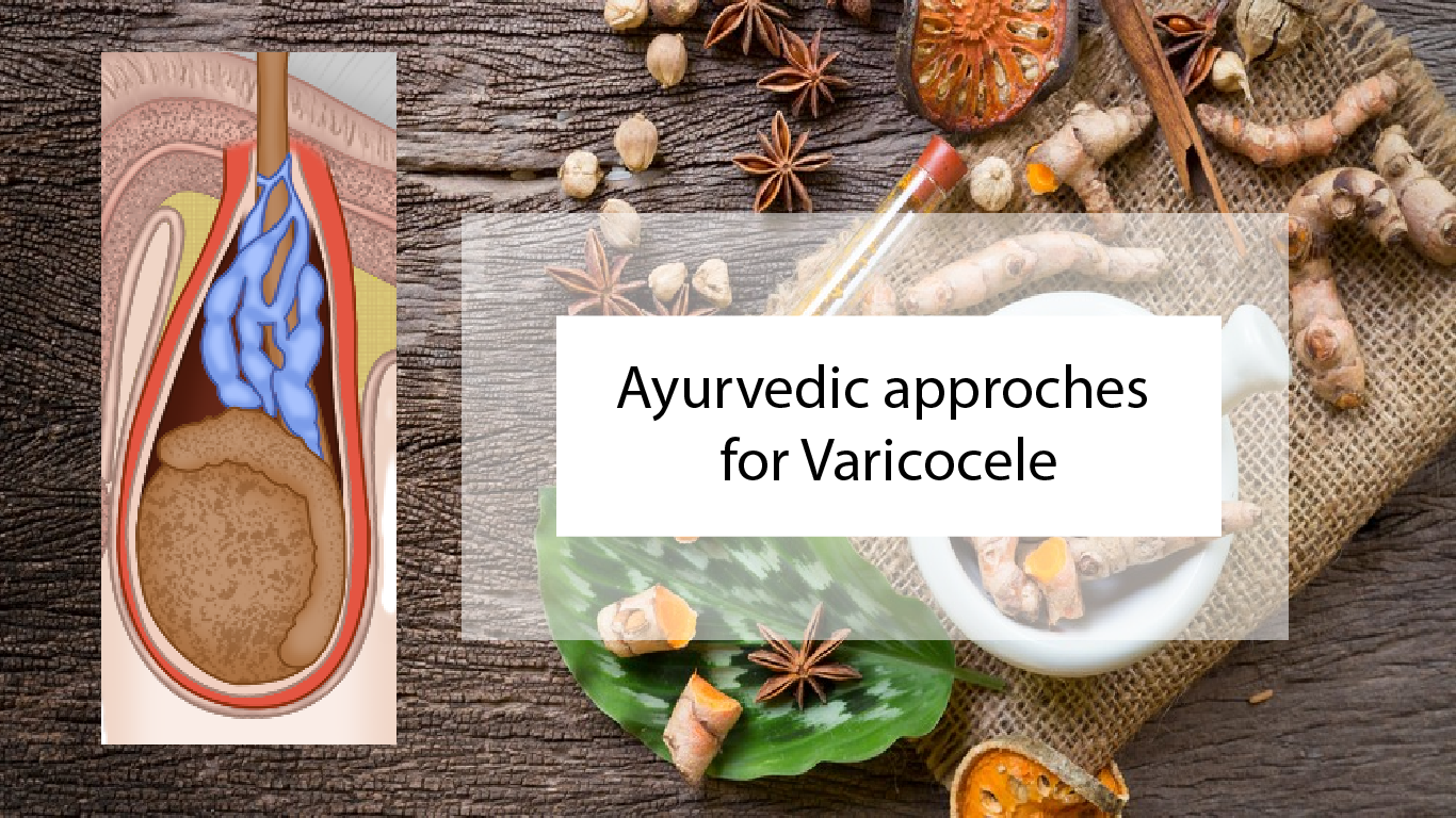 Effectual Varicocele Treatment in Ayurveda: Natural Healing - medagg