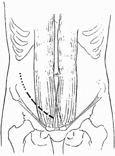 Understanding the Kidney Transplant Scar