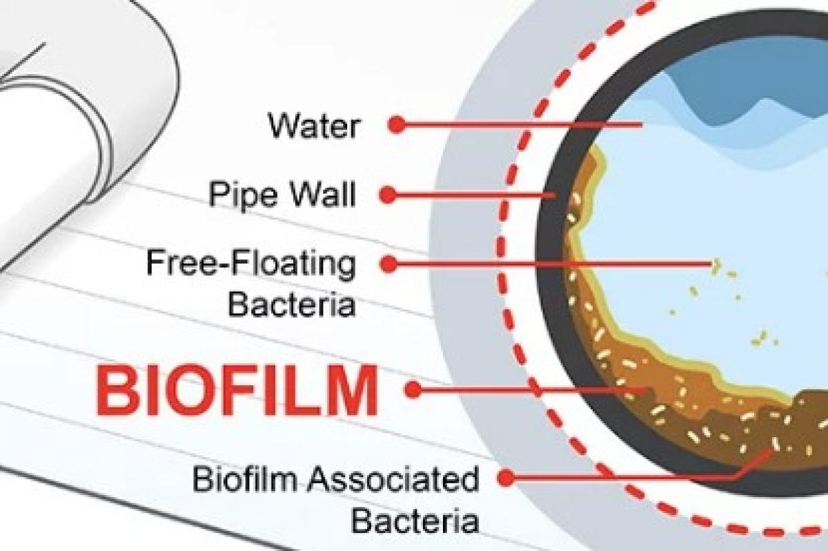 Bacteria Buildup and Biofilm Formation