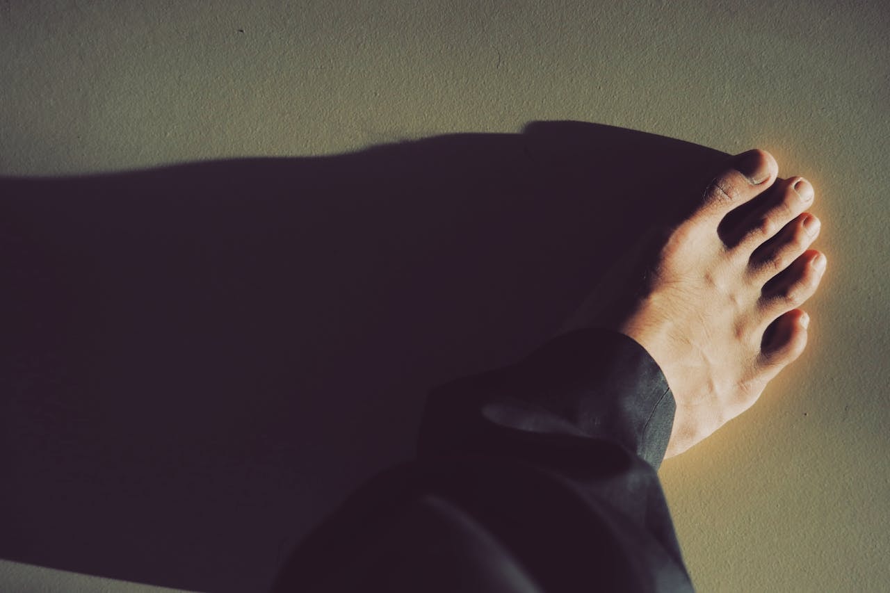 Bare foot viewed from above on a plain surface, a simple visual used to discuss types of bunionectomy surgery and bunion-related toe alignment.