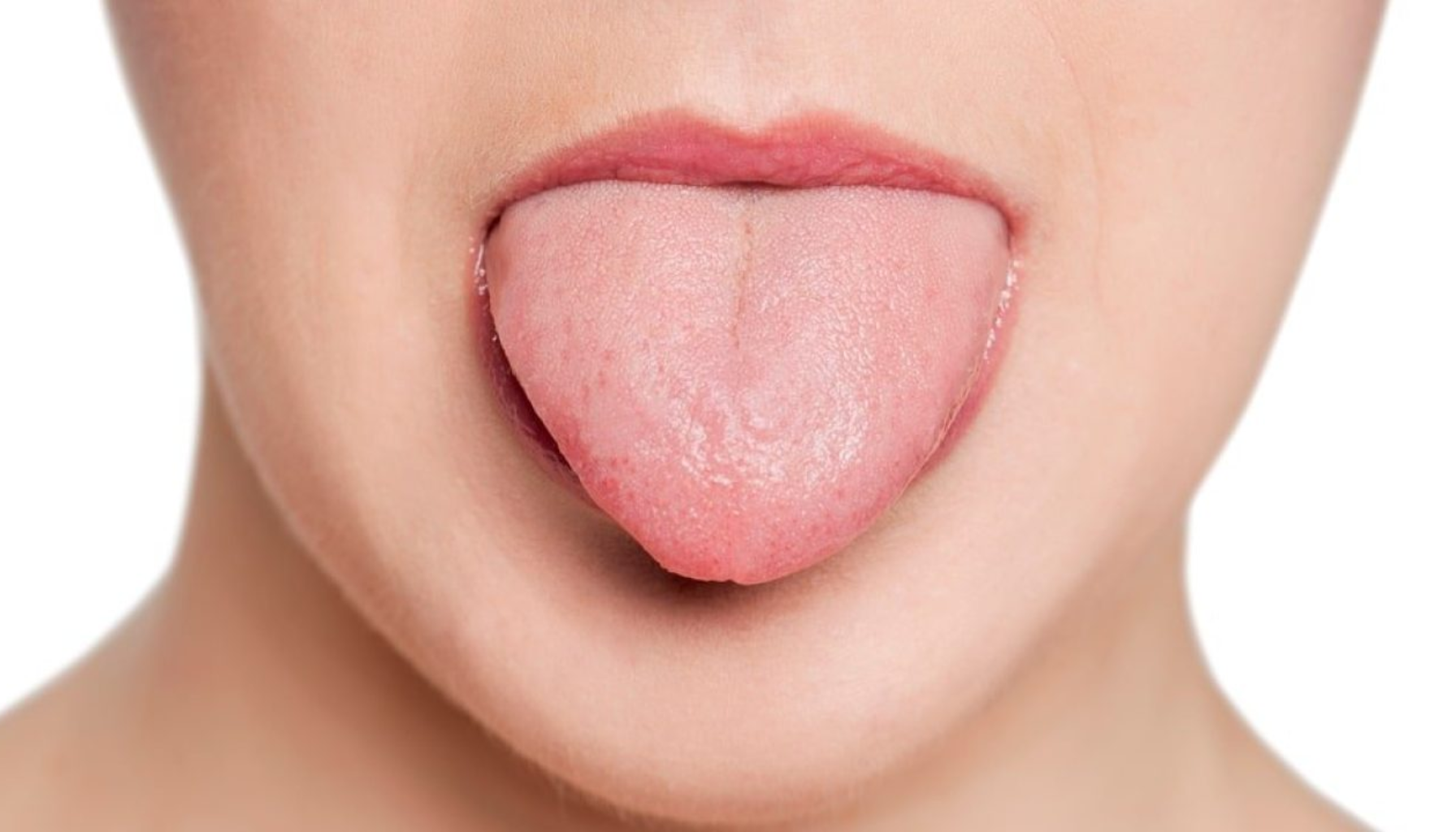 Nærbilde av voksen person som stikker ut en lys rosa tunge for medisinsk vurdering.