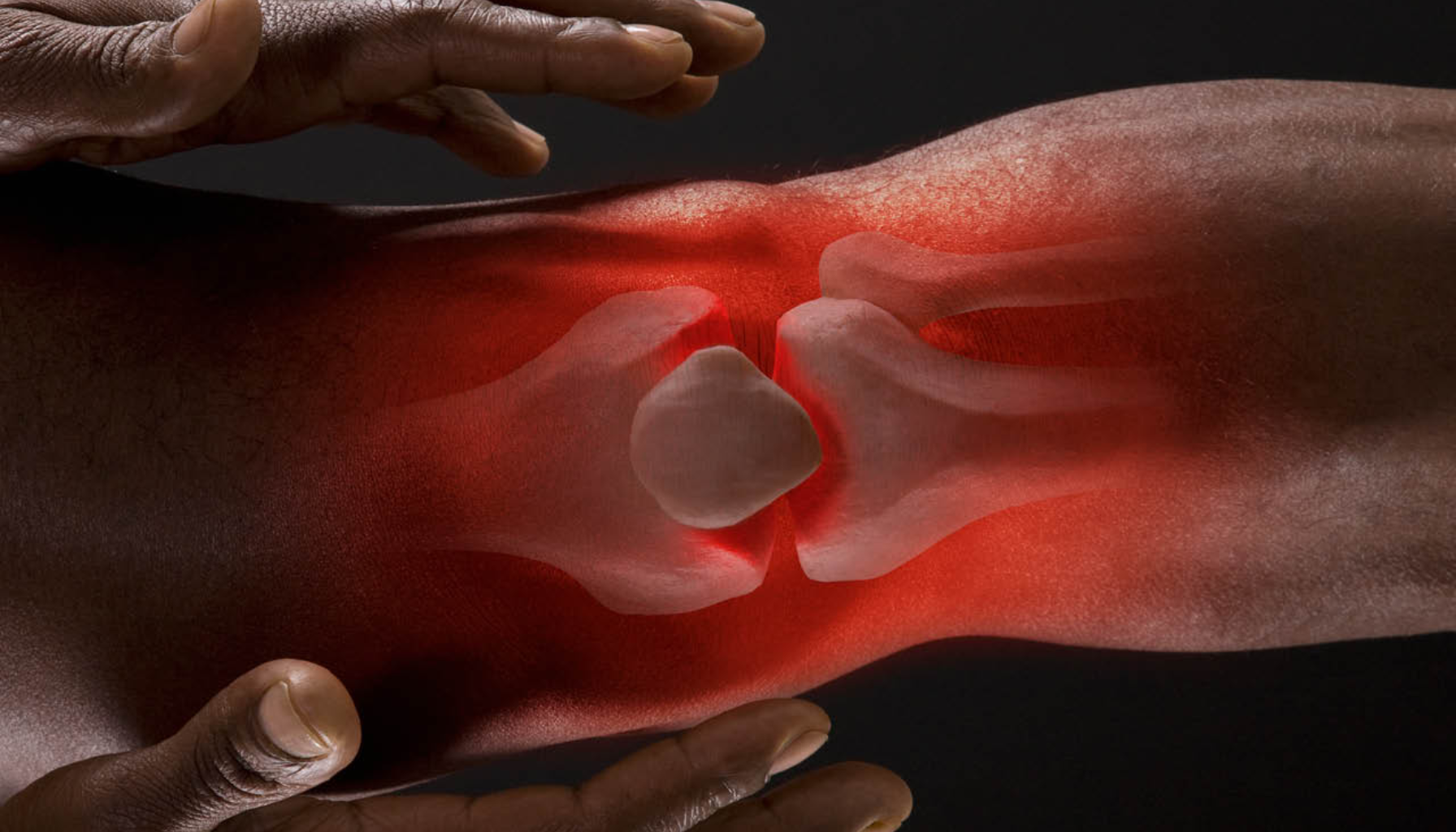 "Betent kneledd med rødt område og hender som holder kneet, viser leddsmerte og betennelse." betennelse kronisk betennelse betennelse i kroppen akutt betennelse autoimmune sykdommer kroniske betennelser kroppen kronisk ofte inflammasjon vevet betennelser eksempel infeksjon mer akutt skade immunforsvaret vev kroniske betennelsen celler symptomer smerte fører brukes ulike området kroppens infeksjoner gir andre sykdommer behandling sykdom kommer gjør akutte typer virus rødhet varme oppstår medisiner årsaker type autoimmune flere hevelse funksjon smerter går gang bakterier tid skjer mye nedsatt gjennom skadet gjøre reaksjon bruker ledd samt fem lege søk stedet trenger fysisk huden tillegg grunn vanligste videre nok ser dempe viktig