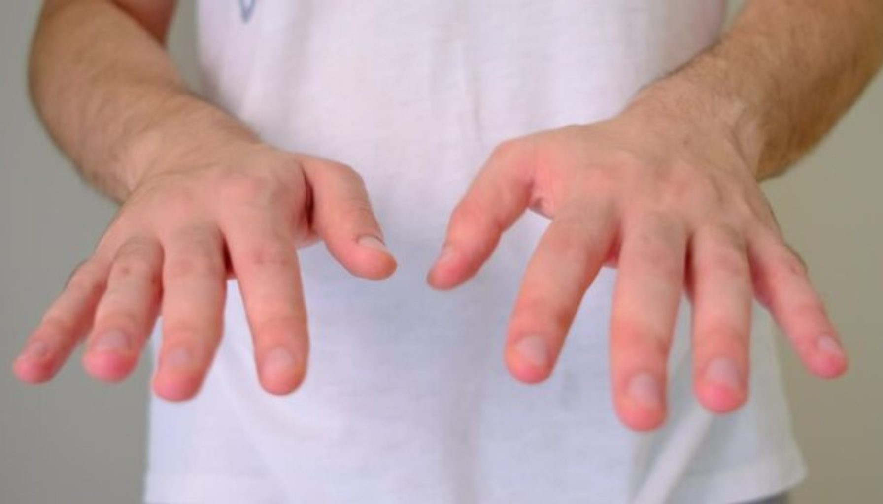 Tremor: Når Kroppen Rister Ukontrollert