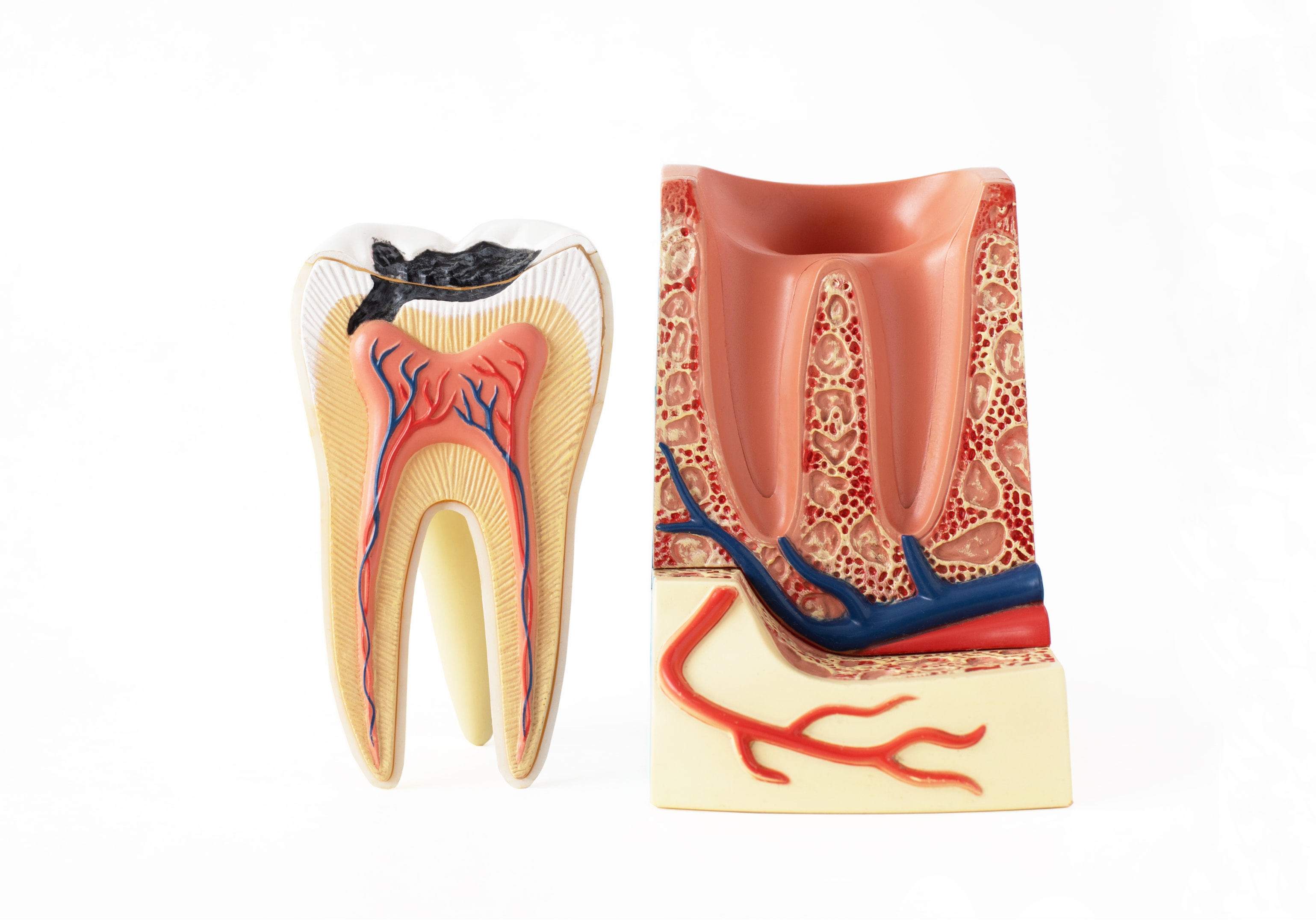 Image showing a wisdom tooth after extraction