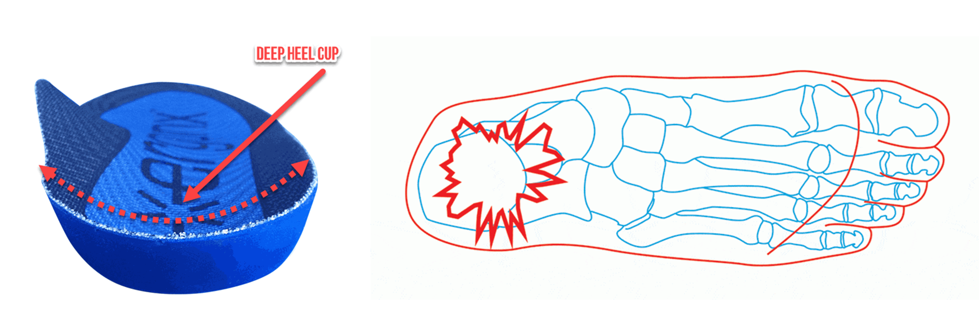 Work Boot Insoles How to Choose the Right Orthotics Ergonx