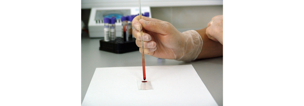 blood, sample, lab