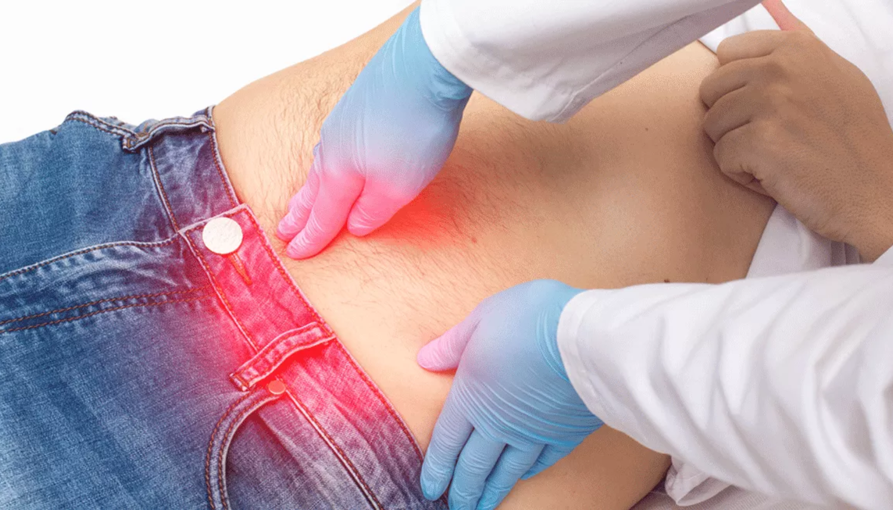 Brokk – Symptomer, typer og behandling 15 "Lege undersøker pasientens mageområde med blå hansker, rødlig markert område indikerer smerte eller brokk."