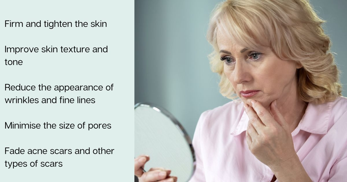 Sagging skin needling treatments