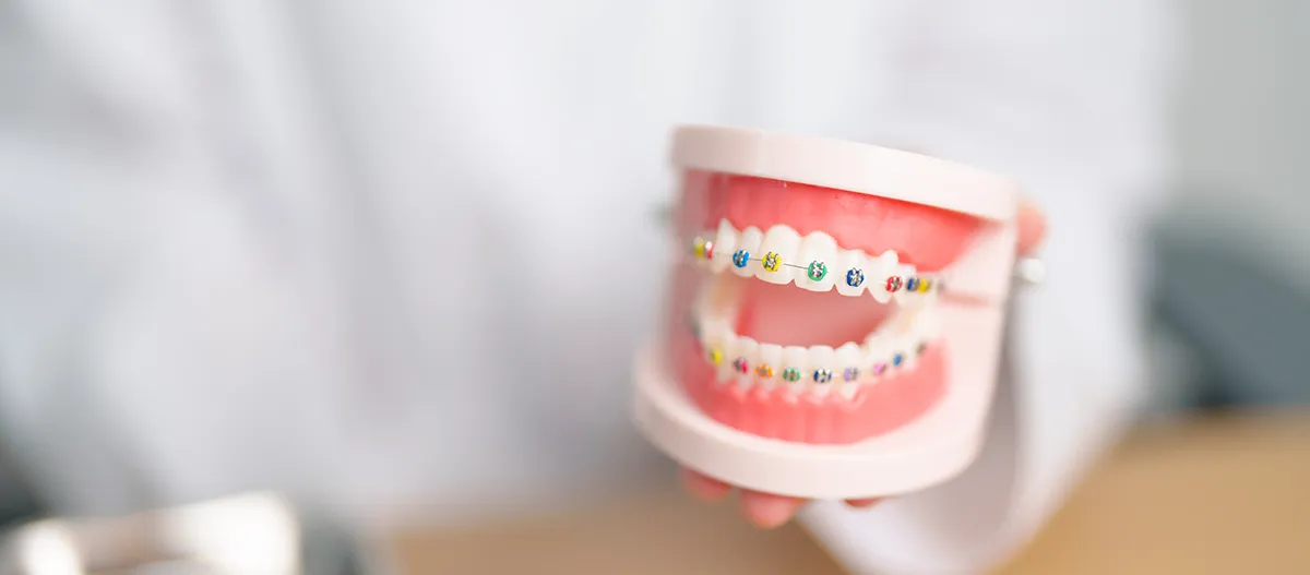 A pink and white educational model showing teeth with colorful brackets