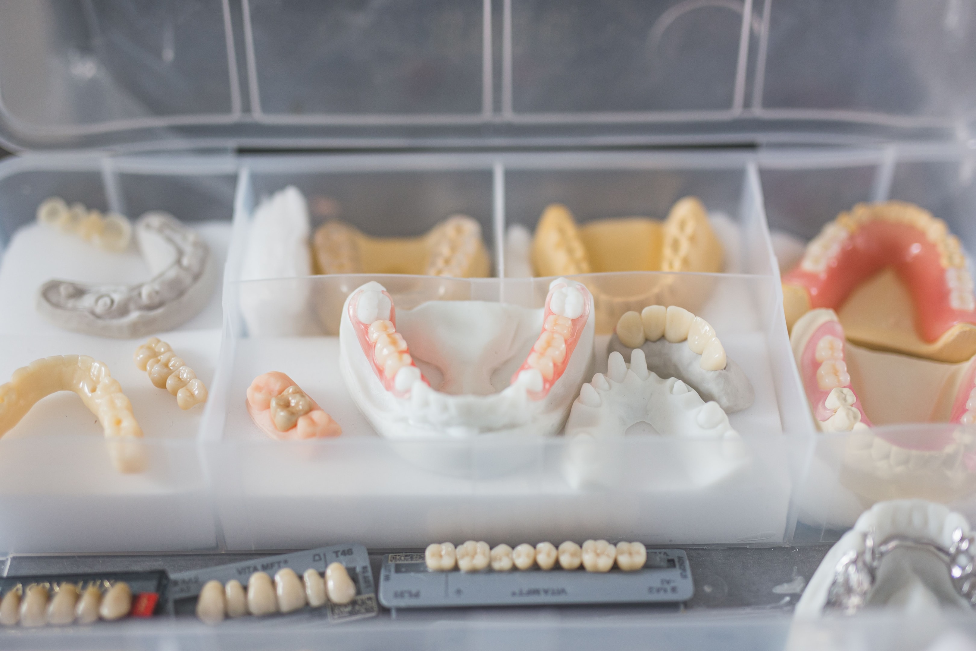 Example of before dental implant procedures.