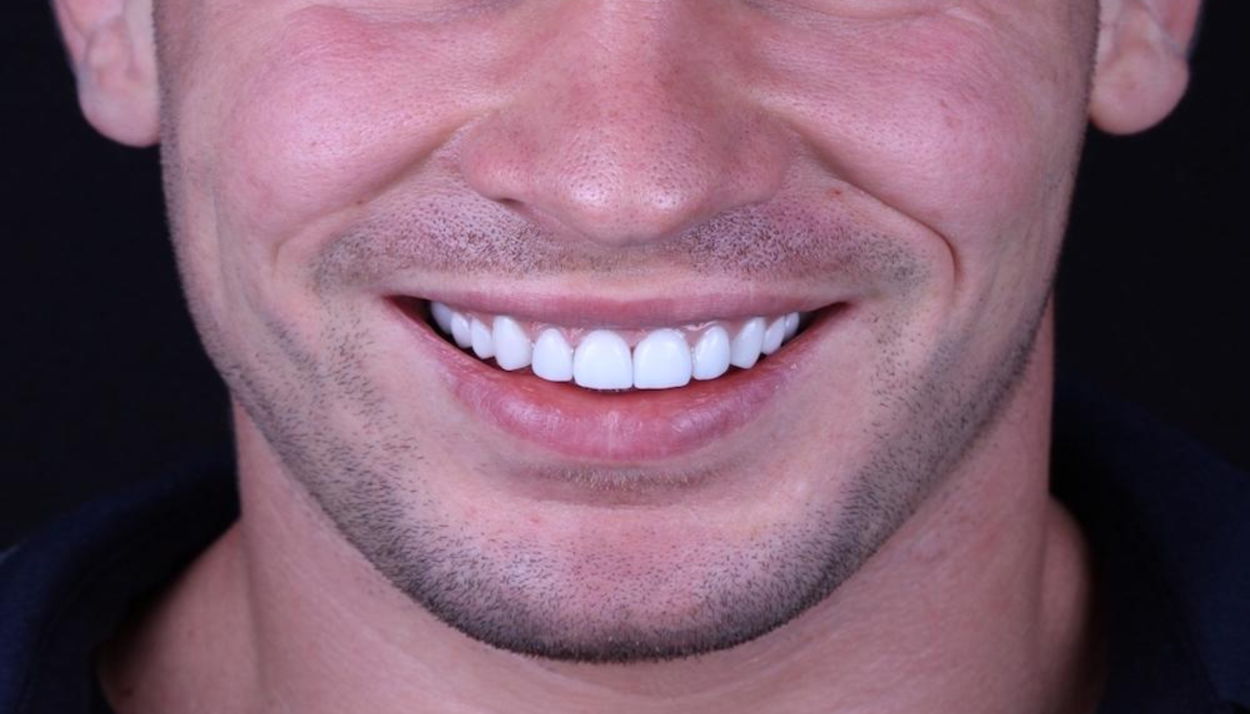 Ung mann smiler og viser perfekte, hvite tenner med jevn tanngard foran mørk bakgrunn. falske tenner som ser ekte ut kunstige tenner tenner tann falske tennene tannen dine ser mangler manglende tannlegen nye erstatte får andre kommer hos naturlige god helt gjør flere ofte ekte egne dag ønsker laget grunn mye veldig tannleger spørsmål passer hjelper annen pris godt svært imidlertid munnen først uansett