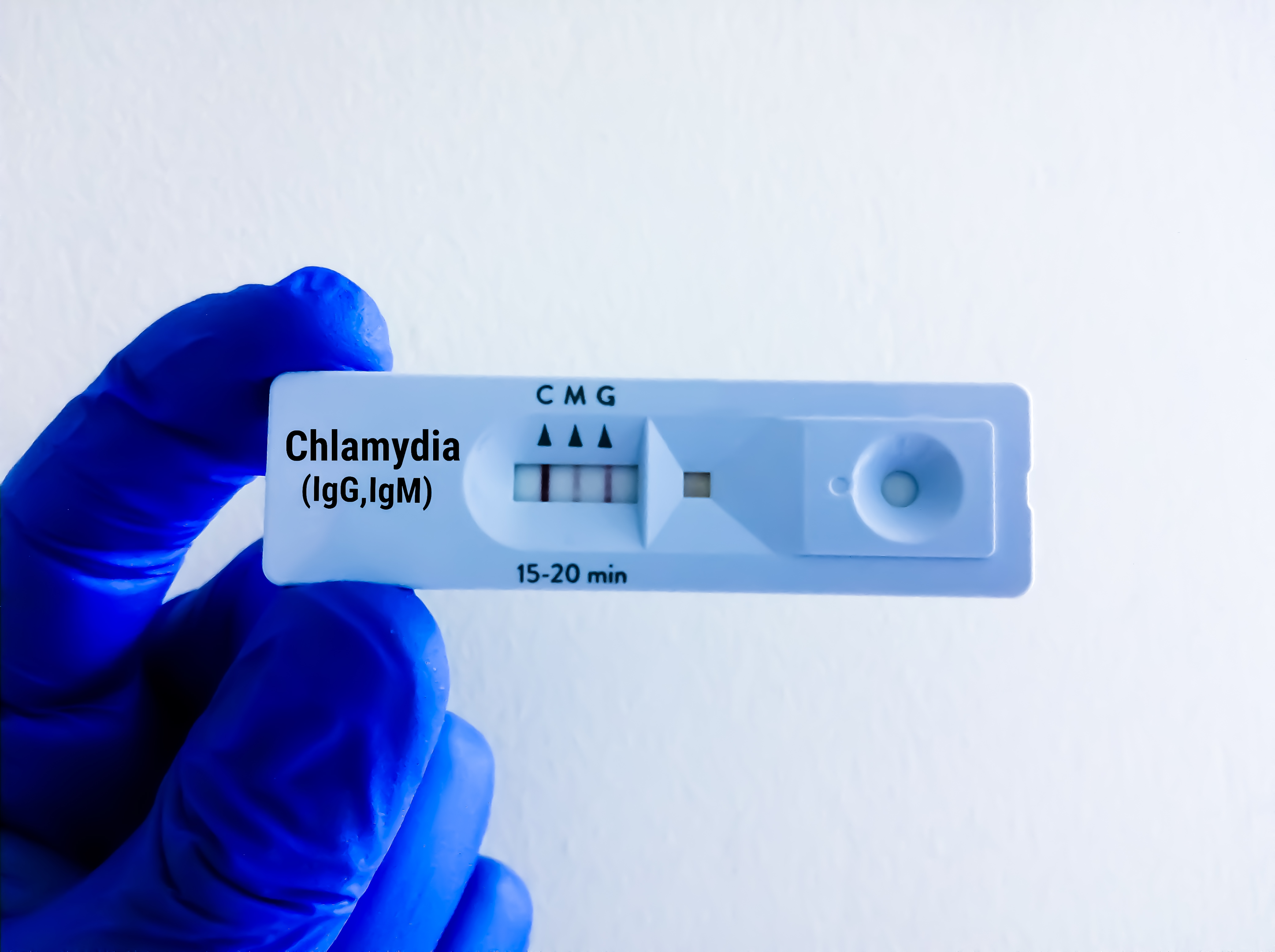 chlamydia is one of the most common sexually transmitted diseases 