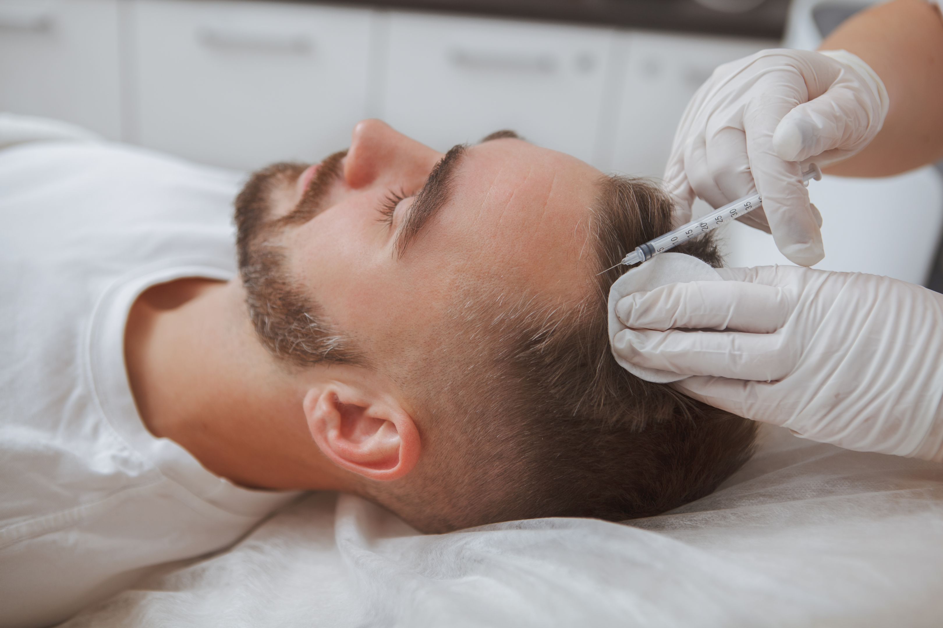 A man receiving treatment for hair loss.
