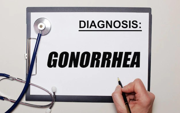 Gonorrhea can be diagnosed using multiple tests